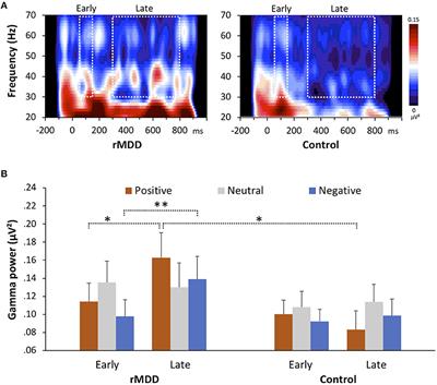 Altered Gamma-Band Activity as a Potential Biomarker for the Recurrence of Major Depressive Disorder